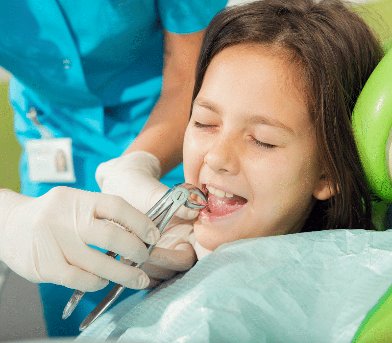 Teeth-Extractions