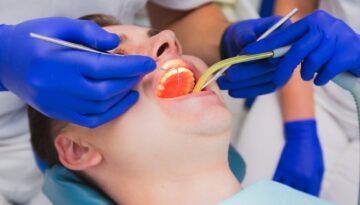 Emergency-Dental-Fillings