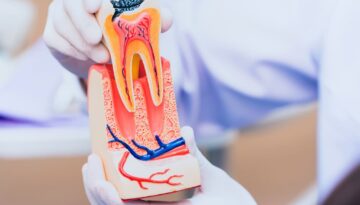 Painful-Tooth-It-Could-Be-Time-for-a-Root-Canal-Treatment-in-Hamilton