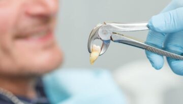 Understanding-the-Process-of-Teeth-Extractions-in-Hamilton