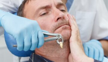 Wisdom-Teeth-Extractions-in-Hamilton-A-Rite-of-Passage-for-Many