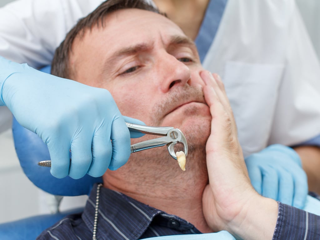 Wisdom-Teeth-Extractions-in-Hamilton-A-Rite-of-Passage-for-Many