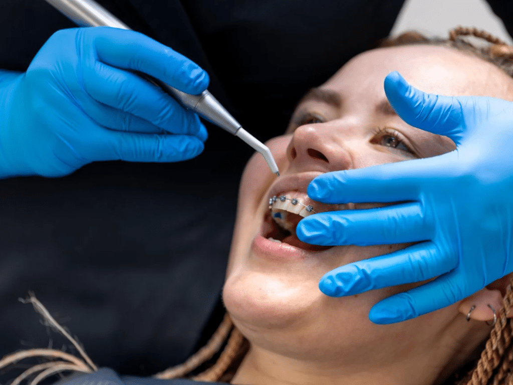 Dental Hygiene for Braces The Complete Guide to Brushing and Flossing with Orthodontics