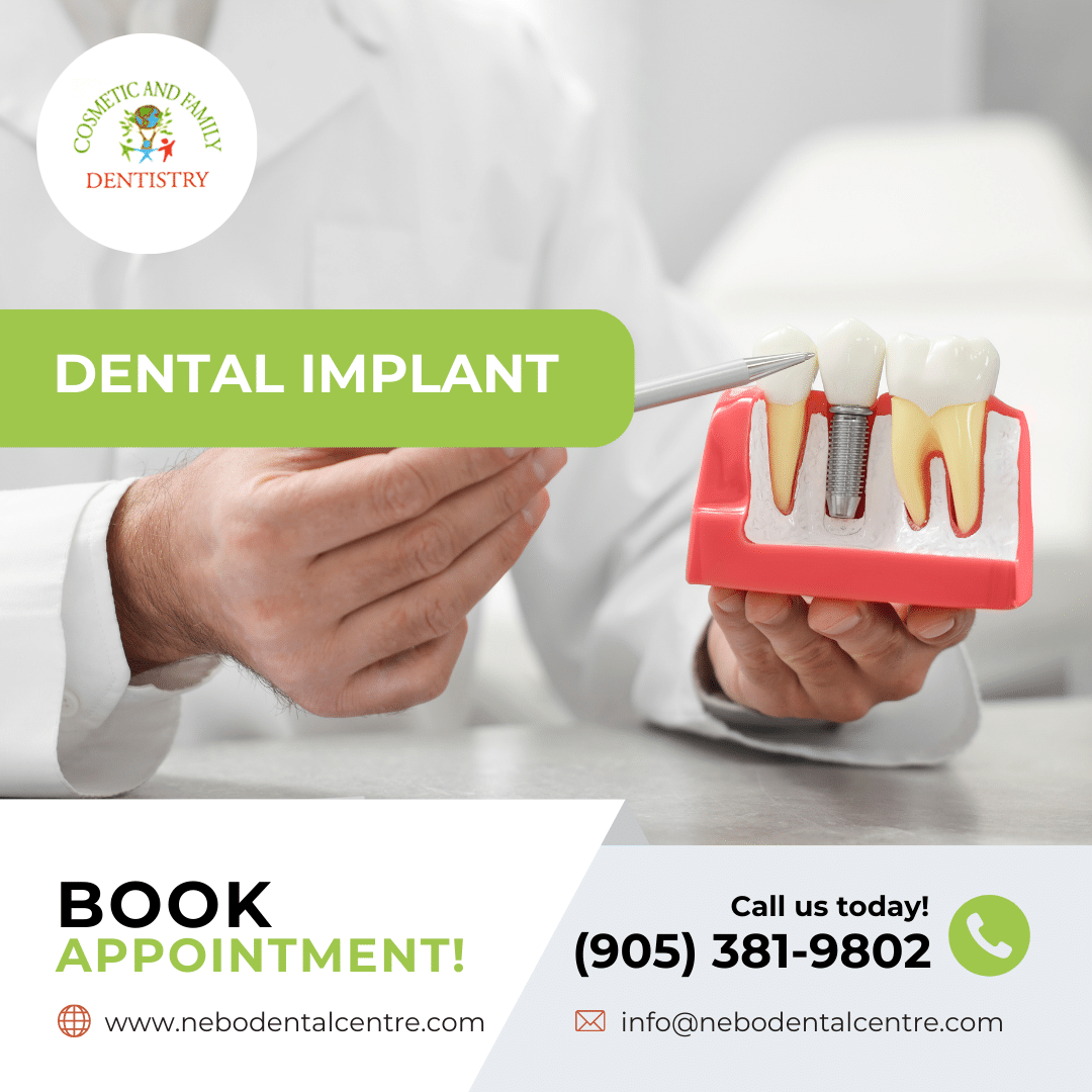 Dental Implant