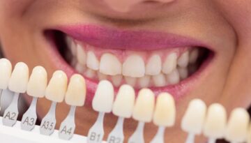 How-to-Maintain-Your-White-Smile-After-Teeth-Whitening-in-Hamilton