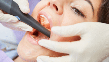 Root Canal