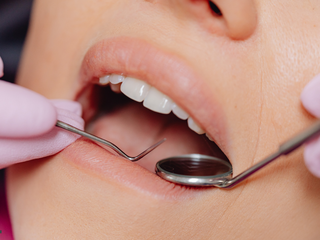 Root Canal Recovery What to Expect and How to Manage Post-Treatment Discomfort