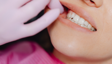 Fixing a Chipped Front Tooth Restoring Your Smile Without Breaking the Bank