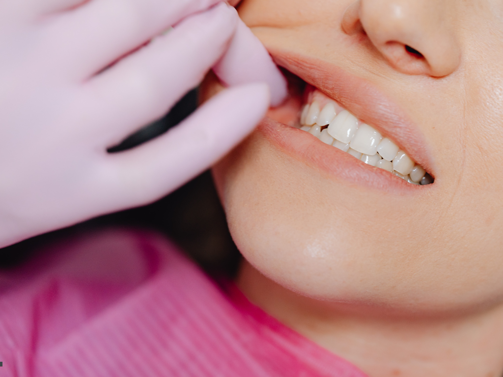 Fixing a Chipped Front Tooth Restoring Your Smile Without Breaking the Bank